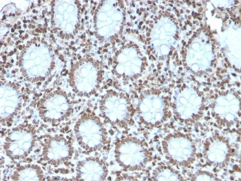 Recombinant Histone H1 Antibody