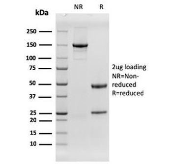EGFR Antibody / EGF Receptor