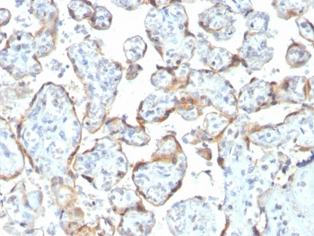 Recombinant TIMP2 Antibody