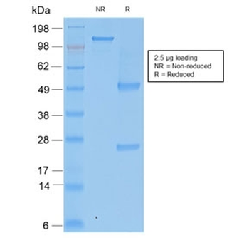 Recombinant TIMP2 Antibody