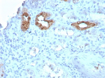 CALB1 Antibody / Calbindin