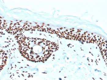 Recombinant Nucleophosmin Antibody / NPM1