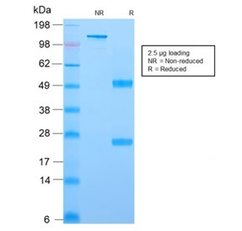 Recombinant YB-1 Antibody