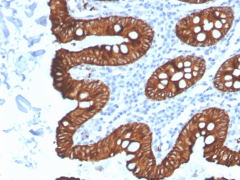 Recombinant Cytokeratin 8 Antibody / Rabbit Monoclonal
