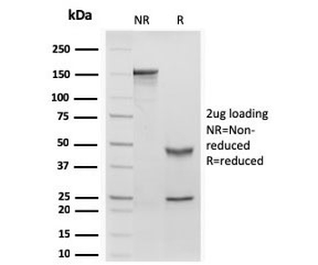 Recombinant RBP-1 Antibody / Retinol Binding Protein 1