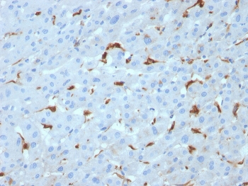 C1QA Antibody / Complement C1q A-Chain