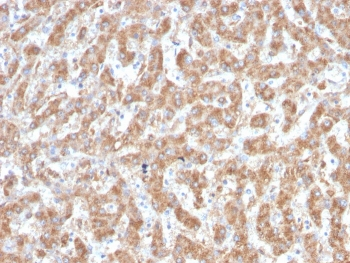 Complement C1q A-Chain Antibody / C1QA