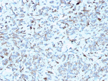 Complement C1q A-Chain Antibody / C1QA