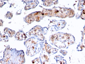 Recombinant FSP1 Antibody / S100A4