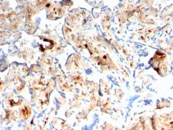 Recombinant FSP1 Antibody / S100A4