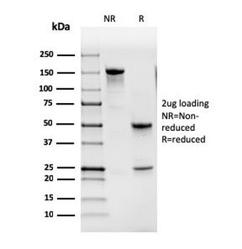 GM-CSF Antibody