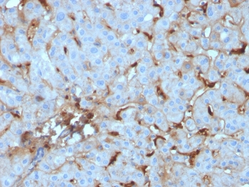 C1QA Antibody / Complement C1q A-Chain