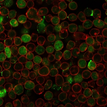 Recombinant Thymidylate Synthase Antibody