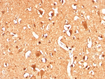 Recombinant Ubiquitin Antibody