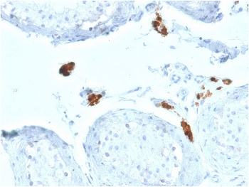 CALB2 Antibody / Calbindin 2 / Calretinin