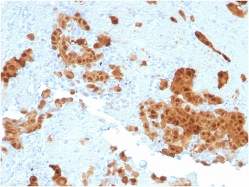 CALB2 Antibody / Calbindin 2 / Calretinin