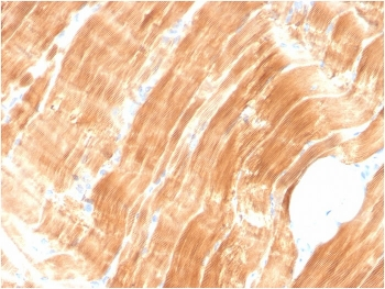 Actinin Alpha 2 Antibody / Sarcomeric Alpha Actinin / ACTN2