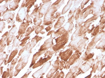 Actinin Alpha 2 Antibody / Sarcomeric Alpha Actinin / ACTN2