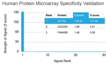 Actinin Alpha 2 Antibody / Sarcomeric Alpha Actinin / ACTN2