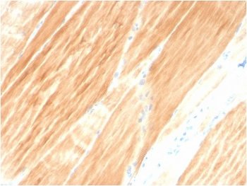 Actinin Alpha 2 Antibody / Sarcomeric Alpha Actinin / ACTN2