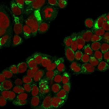 EBAG9 Antibody / Estrogen Receptor Binding Site Associated Antigen 9 / RCAS1