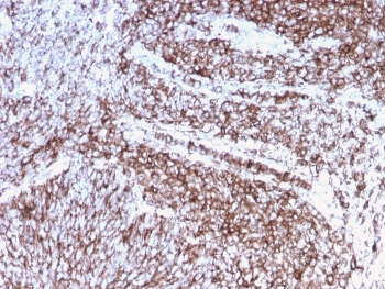 Recombinant CD44 Antibody / HCAM