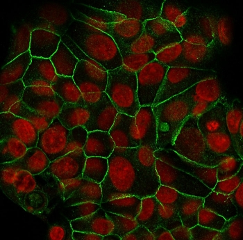 E-Cadherin Antibody / CDH1