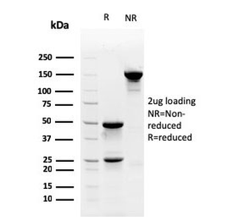 Myofibroblast Antibody