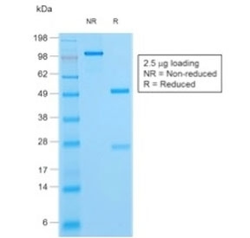 HSV1 Antibody / Herpes Simplex Virus Type I