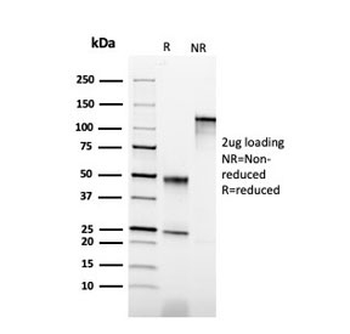 Cytokeratin 6B Antibody