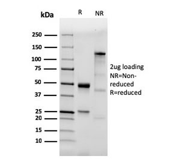 Recombinant TLR2 Antibody