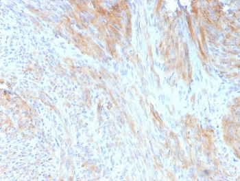 Aciculin Antibody / PGM5 / Phosphoglucomutase 5