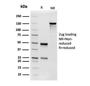 Aciculin Antibody / PGM5 / Phosphoglucomutase 5