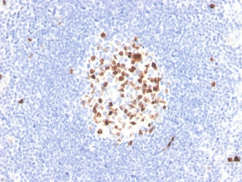 Recombinant TOP2A Antibody / Topoisomerase II alpha