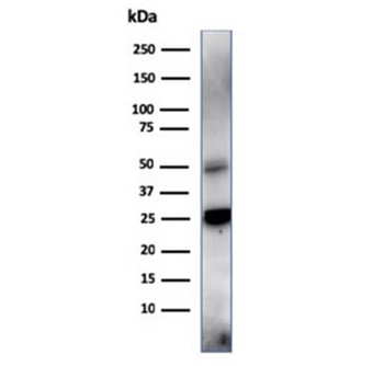 TIM3 Antibody / HAVCR2