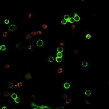 Recombinant CD4 Antibody