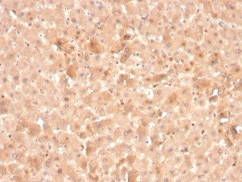 F7 Antibody / Factor VII
