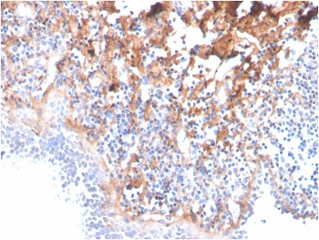 Fibronectin Antibody