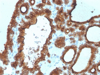 Thyroid Peroxidase Antibody / TPO
