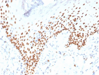 Recombinant p40 Antibody / deltaNp63