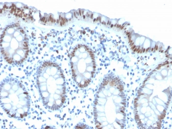 Recombinant PHH3 Antibody / Histone H3 (pSer10)