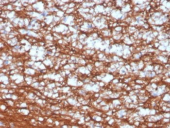 Recombinant PGP9.5 Antibody