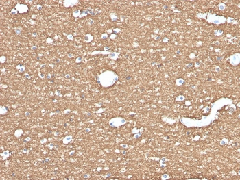 Myelin Basic Protein Antibody