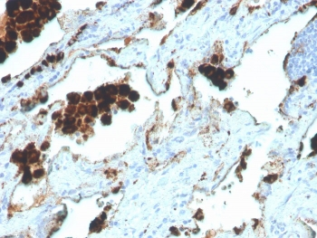 Recombinant Napsin A Antibody
