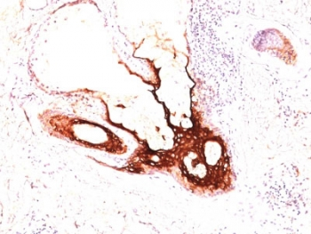 Cytokeratin 17 Antibody