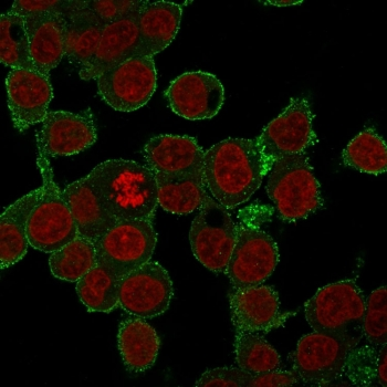 TNF-alpha Antibody