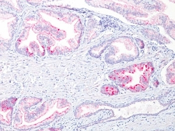 p504S Antibody / AMACR