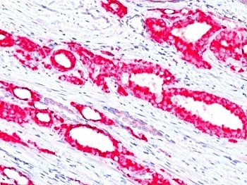 p504S Antibody / AMACR
