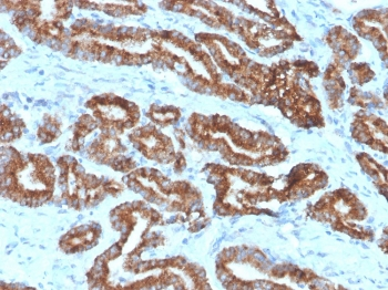 p504S Antibody / AMACR
