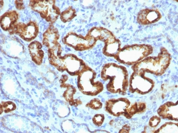 p504S Antibody / AMACR